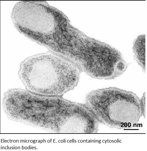 Image:inclusion bodies.jpg